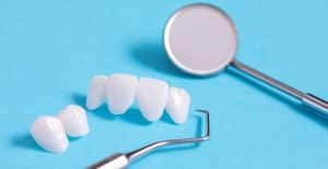 dental bridges in owasso oklahoma