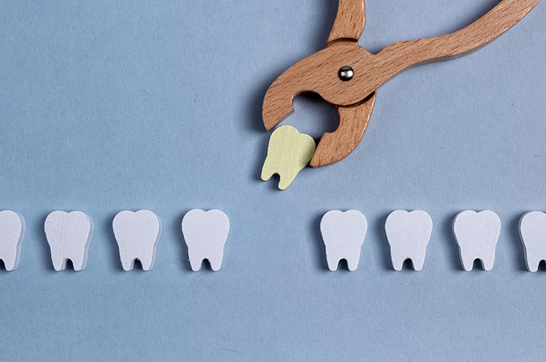 wisdom tooth extraction tools