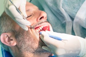 Dental professional examining patient's gums and teeth, illustrating dental fistula diagnosis and treatment.