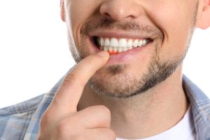 man with inflamed gums