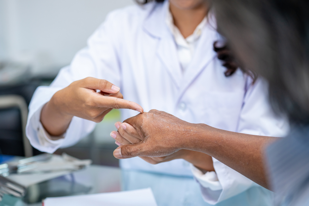 autoimmune conditions