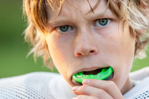 Boy preparing to wear a custom-fitted sports mouthguard, emphasizing dental protection and safety in recreational sports.