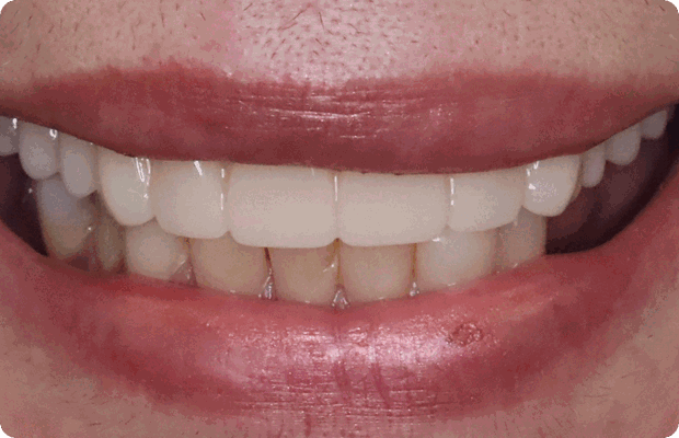 After image