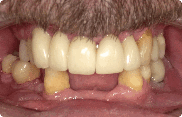 Before image