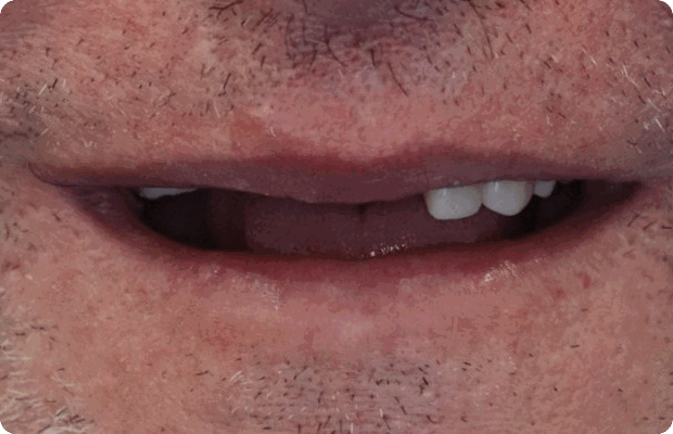 Before image