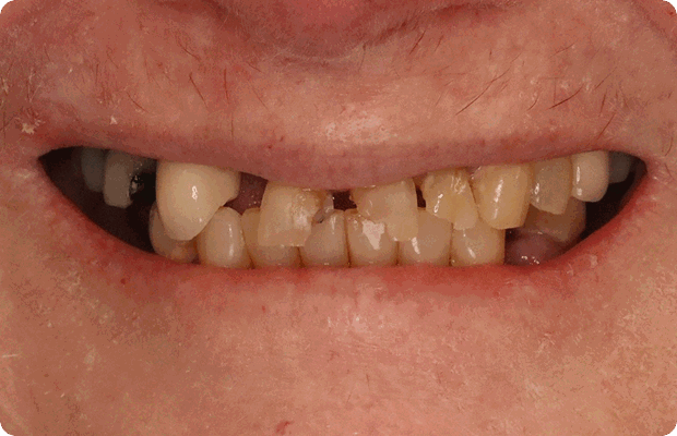 Before image