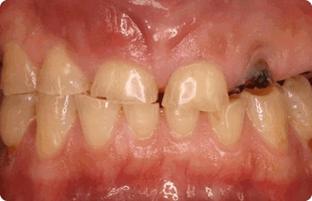 Before image