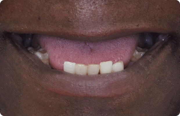 Before image