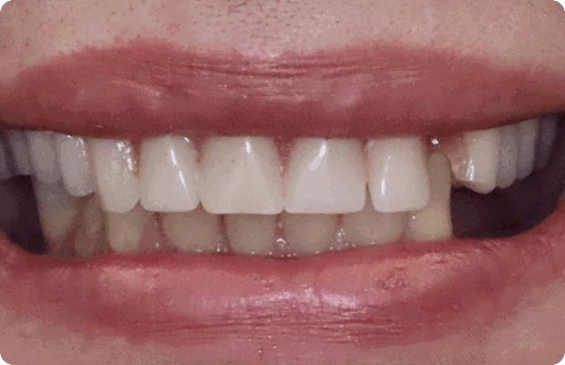Before image