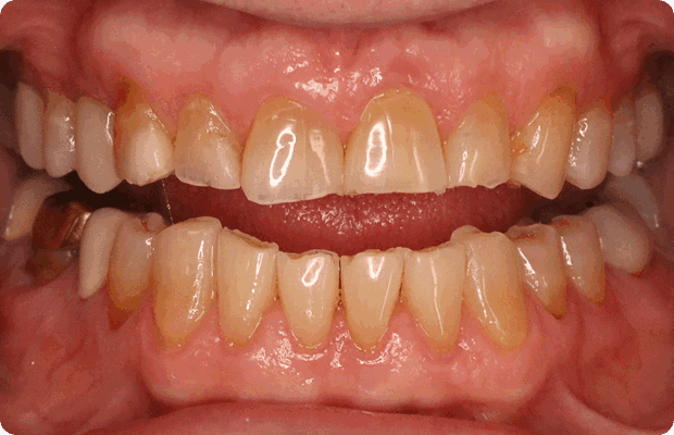 Before image