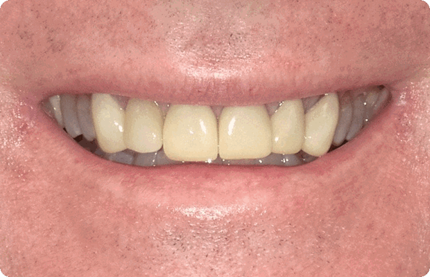 Before image
