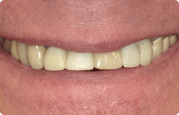 Before image