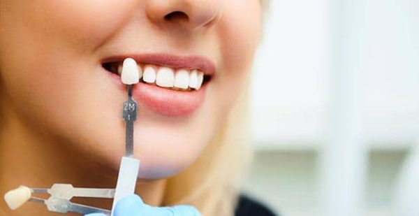 Woman smiling while a dental professional holds a color-matching shade guide for porcelain veneers, showcasing the cosmetic dentistry process at Lexington Dental of Owasso.