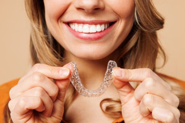 clear aligners